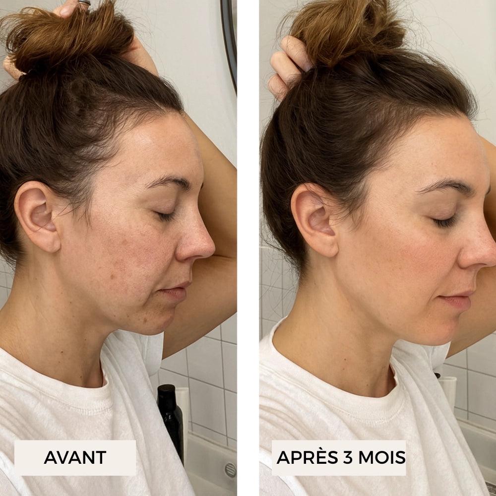 Visuel avant/après peau (femme de profil)
Effet global des gélules Délicure Cheveux & Ongles : peau plus lisse et lumineuse après 3 mois de cure.
