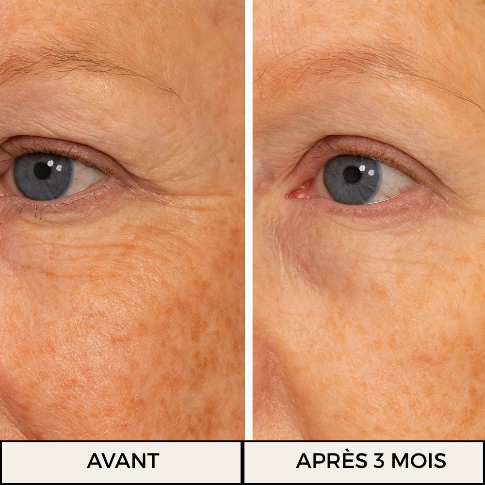 Visuel avant / après peau ridée (femme âgée)
Résultats visibles après 3 mois de cure de Collagène Reggenerate Délicure : réduction des rides, peau plus ferme et hydratée.