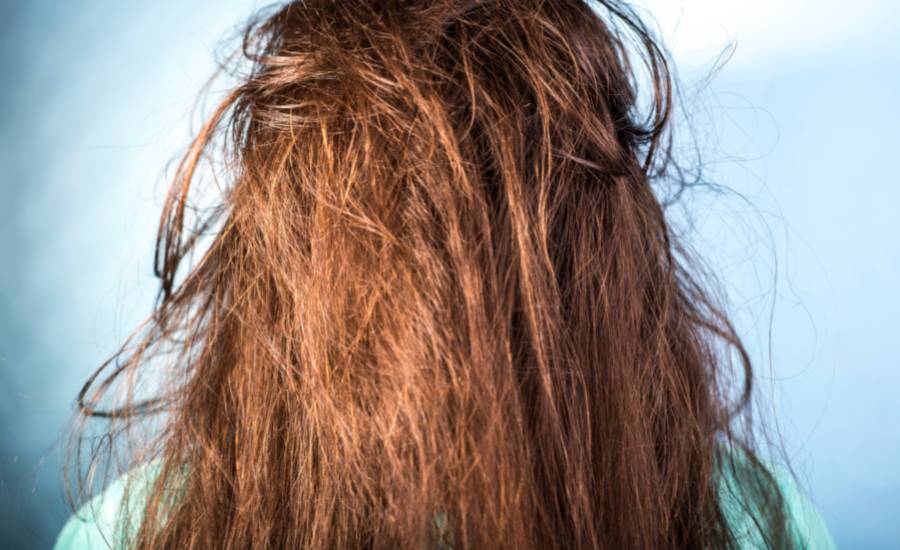 Femme avec cheveux gras