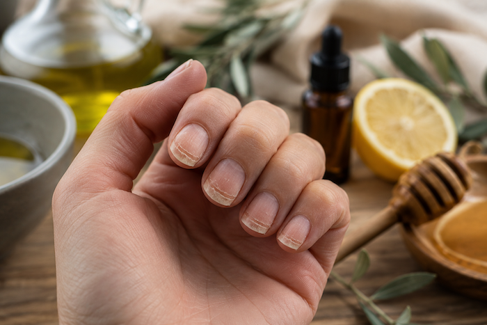 Ongles cassants et dédoublés avec huile d’olive et citron, remèdes naturels pour renforcer les ongles