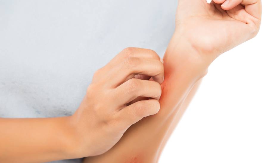 Stress can have an impact on your skin